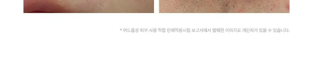[트러블부위 진정케어] 피캄 센텔라 트러블 스팟 15ml 상세페이지 33